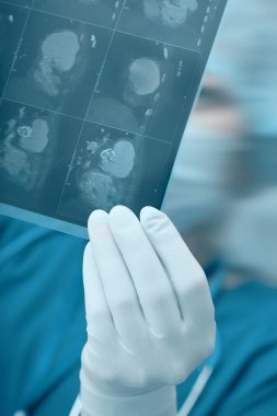 Doktorlar el ile MRI tarama insan karın