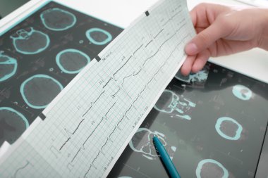 Doktorların çalışma alanı ile tıbbi dokümantasyon