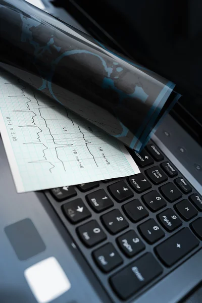 Instrumente der medizinischen Untersuchung auf dem Keyboard-Konzept — Stockbild Instrumente der medizinischen Untersuchung auf der Tastatur — Stockfoto