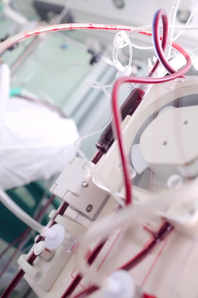 Aparato para hemodiálisis en la habitación del paciente en el hospital — Foto de Stock