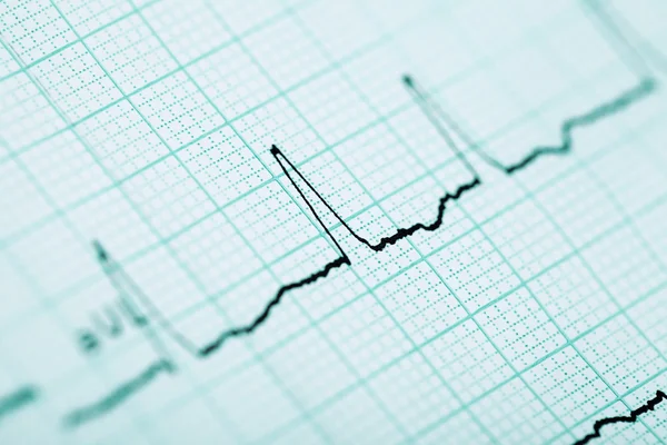 Antecedentes ECG — Foto de Stock