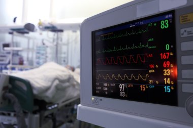 Yoğun bakım hastalarında saat izlenmesi