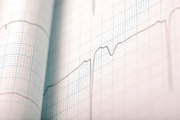 Ecg antecedentes médicos — Fotografia de Stock