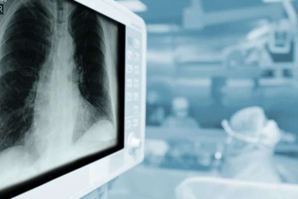 Рентгеновский монитор во время операции с пустым местом для Вас — стоковое фото