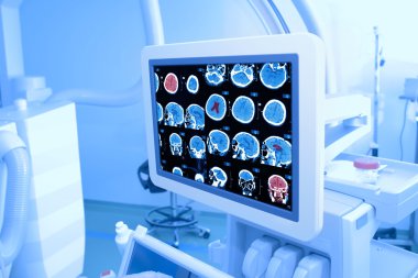 X-ray monitor in the hospital clipart