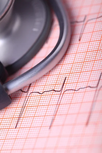 Uzavřít s EKG tisk stetoskopu — Stock fotografie