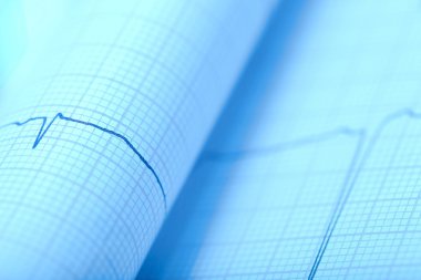 Makro kağıt EKG baskı