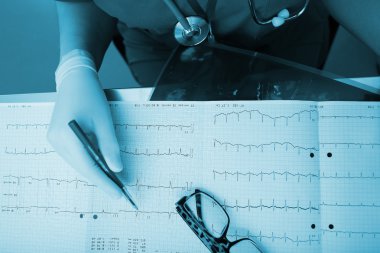 Tıbbi uzmanlar hastanın EKG durumu okuyan