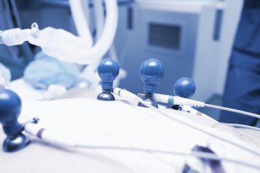 EKG Elektrotları hasta üzerinde