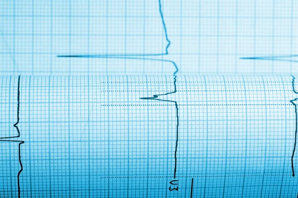 Paper with curve of a seismograph — Stock Photo, Image