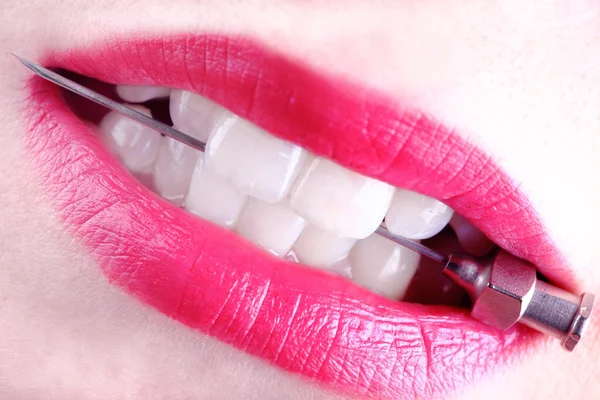 Lékařské vpichovou v bílé zuby mladé ženy. Zavřít- — Stock fotografie