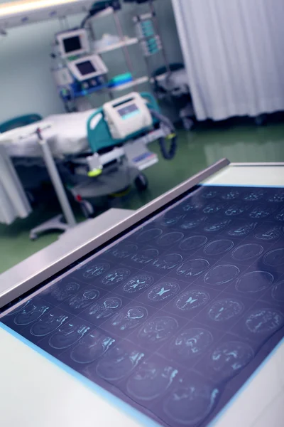 CT scan on the background of the empty ward — Stock Photo, Image