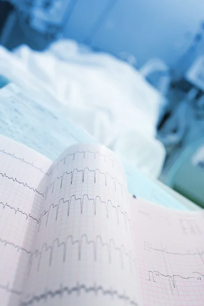 ECG printout near of patients bed — Stock Photo, Image