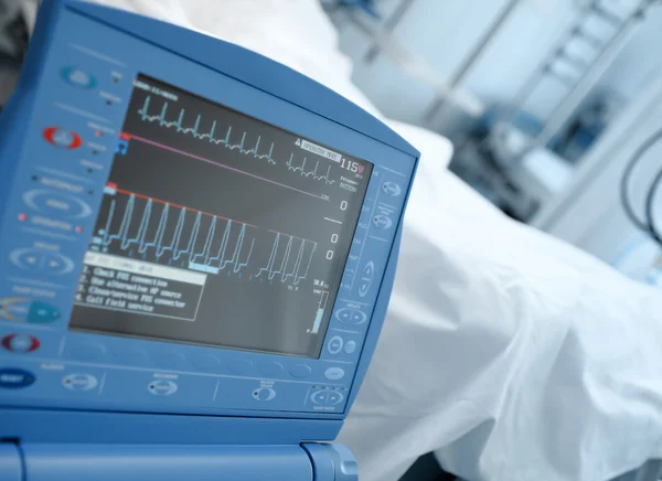 Monitor moderno de UTI em enfermaria clínica ao lado do leito do paciente — Fotografia de Stock