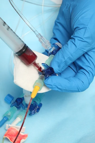 Blood sampling from a patients catheter — Stock Photo, Image