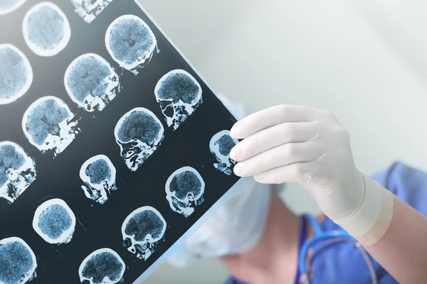 환자의 뇌 파 상태를 공부 하는 의료 전문가 스톡 이미지