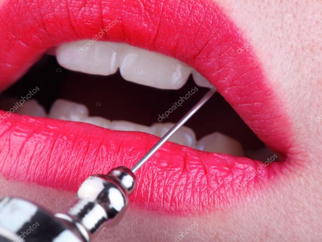 Medical needle in the female mouth ⬇ Stock Photo, Image by © sudok1