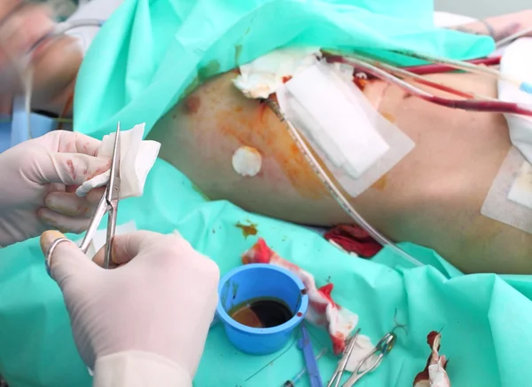 Cirujanos trabajan en el hospital — Foto de Stock