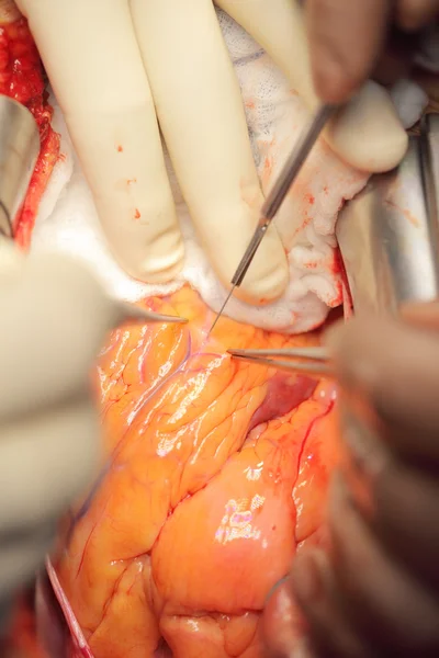 Surgeons working in team — Stock Photo, Image