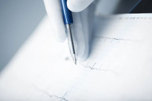 O médico examina o ECG do paciente — Fotografia de Stock