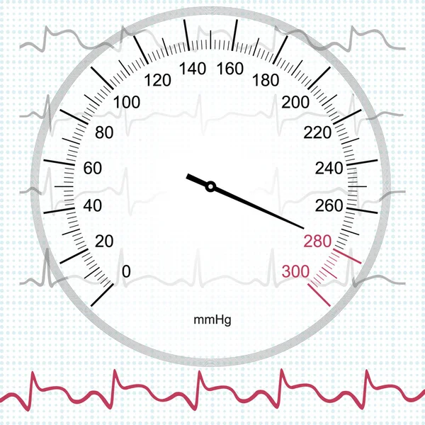 Ipertensione e infarto miocardico — Foto Stock