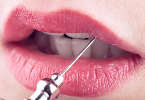 Female lips and medical needle, concept of plastic and aesthetic — Stock Photo, Image