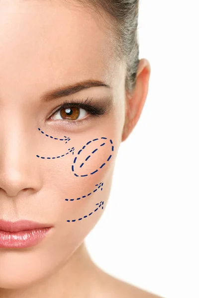 Πλαστική χειρουργική ασιατική γυναίκα cheekbone αύξηση χειρουργική ομορφιά διαδικασία σημάδια σχέδιο στο πρόσωπο — Φωτογραφία Αρχείου