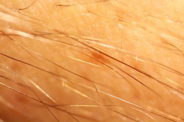 Hairs of human skin — Stock Photo, Image