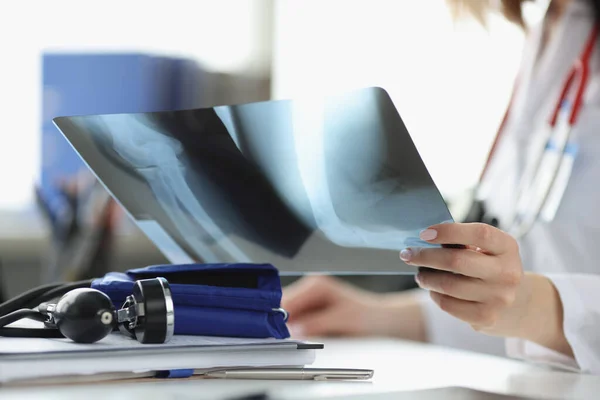 Artsen handen houden röntgenfoto 's in kantoor close-up Stockfoto