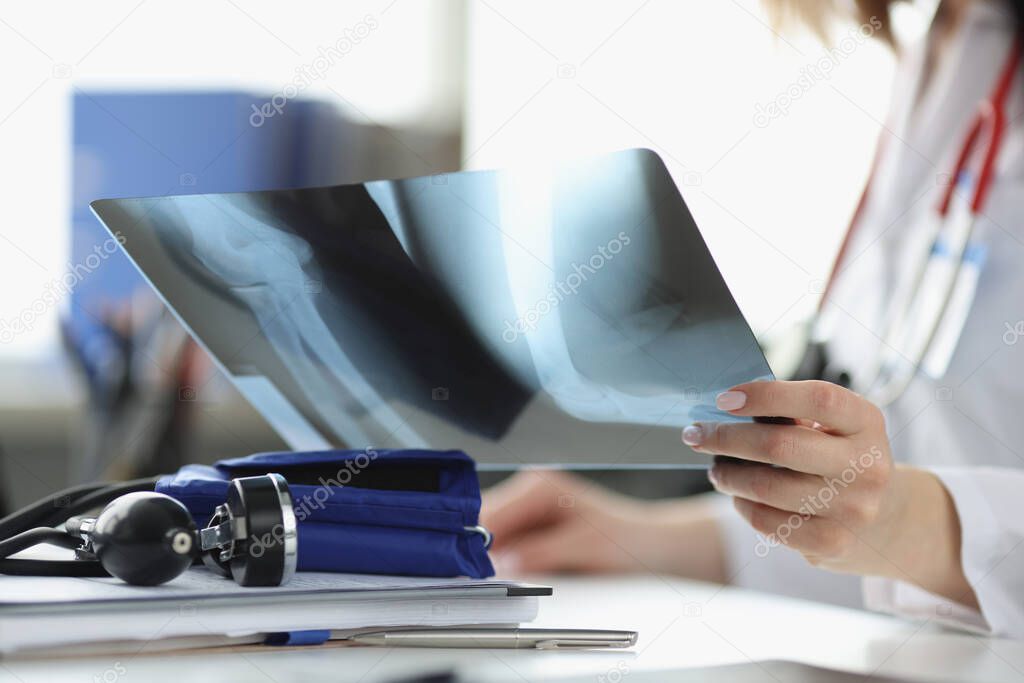 Doctors hands are holding x-ray in office closeup