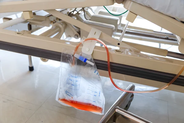 Plastic urine bag hanging under bed with fluid and blood — Stock Photo, Image