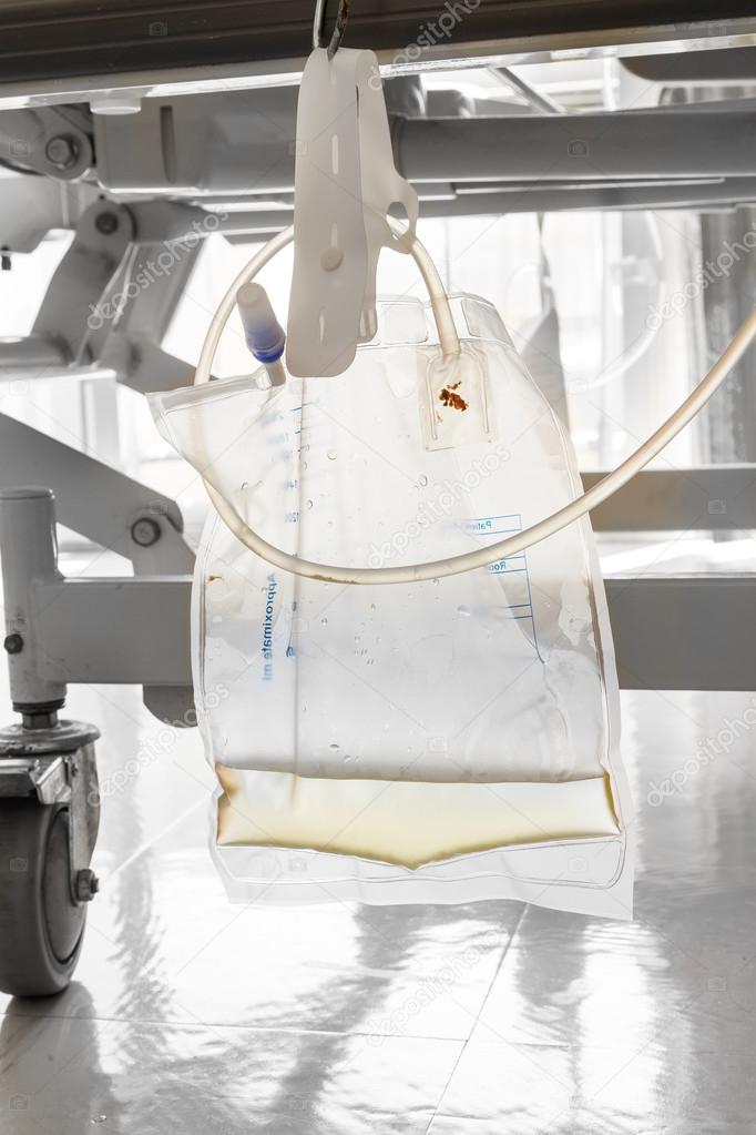 Plastic urine bag hanging under patient bed