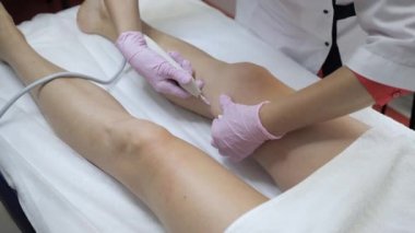 Doktorun elleri pamuk pedleri temizlerken hastanın bacağını karboksiterapi prosedürüne hazırlıyor, vücudu kapatıyor. Doktor bacağını karbondioksit enjeksiyonuna hazırlıyor. Deri etiketlerinin ve gerilmelerin tedavisi