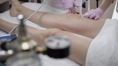 Doktor karbondioksiti hastanın bacağına karbondioksitle enjekte ediyor. Doktor kadın özel aletler kullanıyor. Deri etiketlerinin ve esneme hareketlerinin tedavisi ve çıkarılması. Mezoterapi, ozon terapisi.