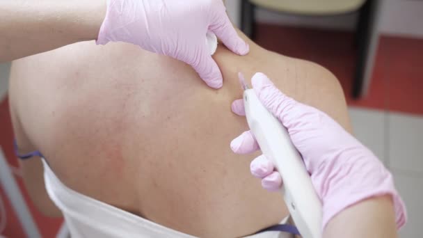 Doktor provádí injekci karboxykarboxyterapie oxidu uhličitého. Osvěžení kůže. Postup se provádí na rameni pacienta. Detailní záběr — Stock video