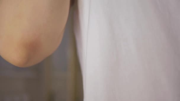 Gros plan d'une jeune femme méconnaissable se gratte les mains. Signes de dermatite et de gale. Concept allergie cutanée — Video