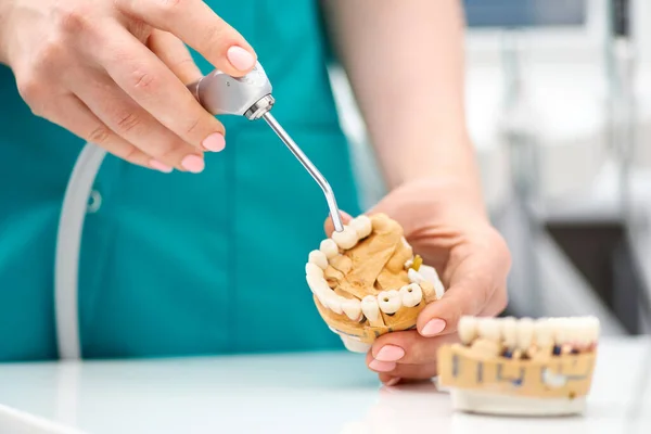 The dentists hand holds an artificial jaw mock-up and shows the patients teeth. Treatment in a dental clinic. Close-up. — Stock Photo, Image