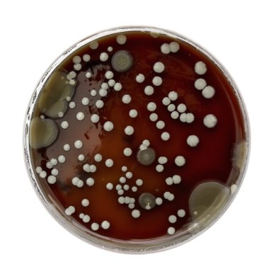 Petri dish ile bakteri kolonileri