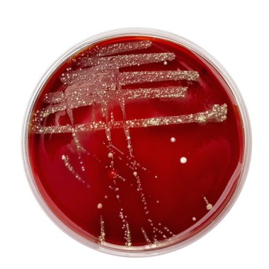 Petri dish ile bakteri kolonileri