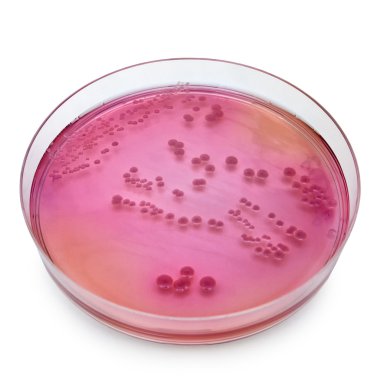 Petri dish ile bakteri kolonileri