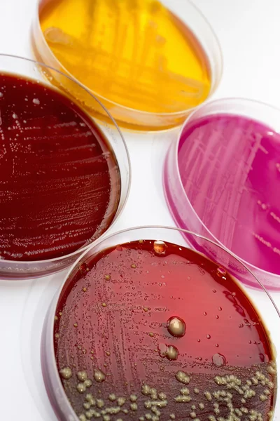Petriskålar med bakterier kolonier — Stockfoto