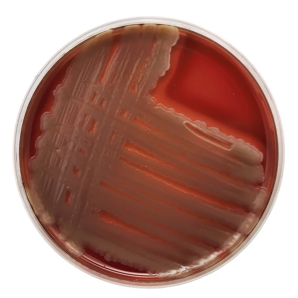 Petriskål med bakterier kolonier — Stockfoto