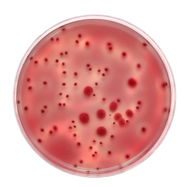 Petriskål med bakterier kolonier — Stockfoto