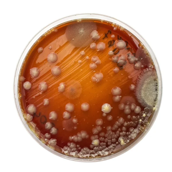 Placa de Petri con colonias de bacterias Imagen de archivo