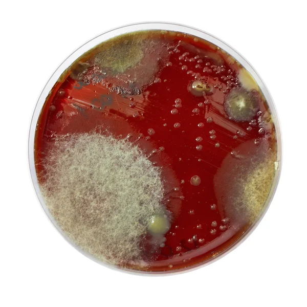 Petri dish with bacteria colonies Royalty Free Stock Images