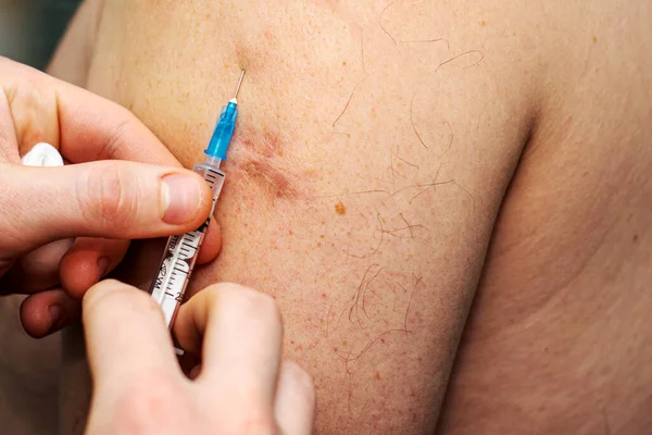 Arts Vaccineert Met Een Spuit Arm Hoge Kwaliteit Foto — Stockfoto