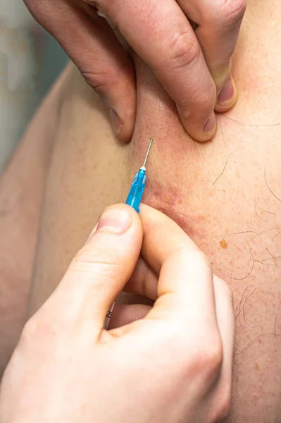 Arts Vaccineert Met Een Spuit Arm Hoge Kwaliteit Foto — Stockfoto