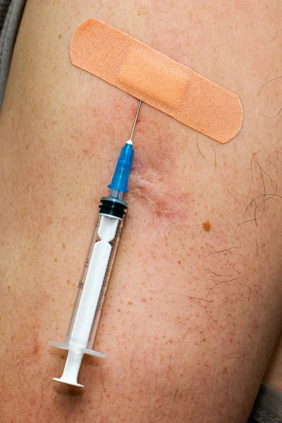 Het Concept Vaccinatie Bestaat Uit Een Hervaccinatie Van Een Naald — Stockfoto