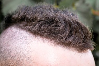 Genç bir adamın kafasında saç tarağı. Yüksek kalite fotoğraf