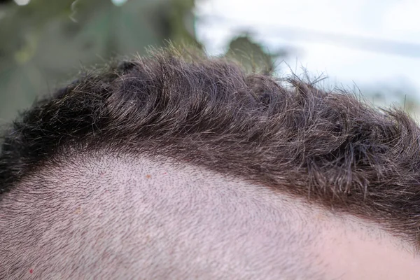 若い男の頭の上に髪型櫛 高品質の写真 — ストック写真